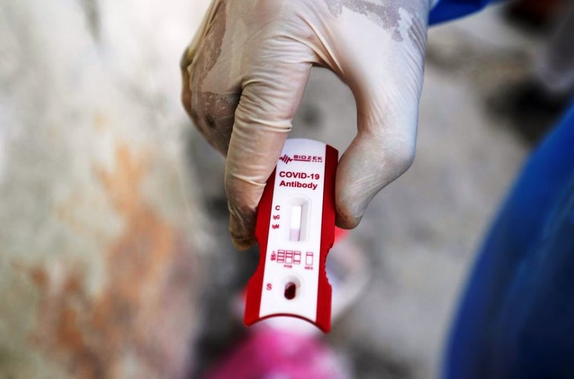 Covid-19: Brasil chega a 47,7 mil mortes e 978,1 mil casos confirmados
